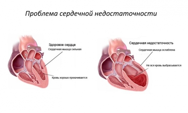 Препарат необходимо аккуратно использовать мужчинам с болезнями сердца