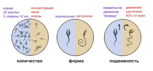 При правильной подготовке к зачатию, сперматозоиды будут иметь хорошие показатели
