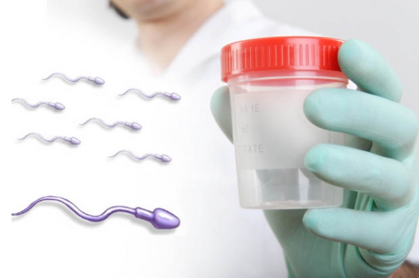 Сперма сдается в одноразовом стерильном контейнере
